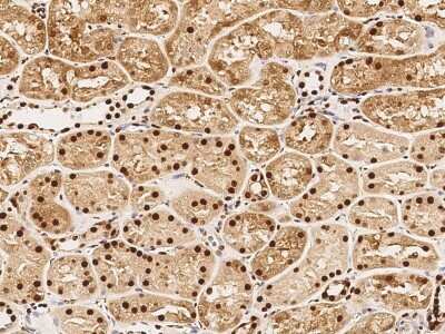Immunohistochemistry-Paraffin: ANP32A Antibody [NBP2-99913]