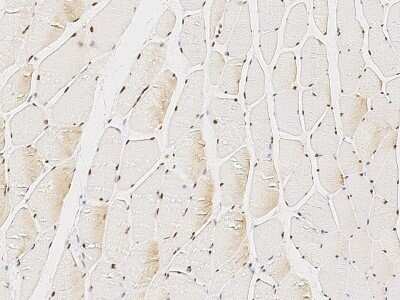 Immunohistochemistry-Paraffin: ANP32A Antibody [NBP2-99913]