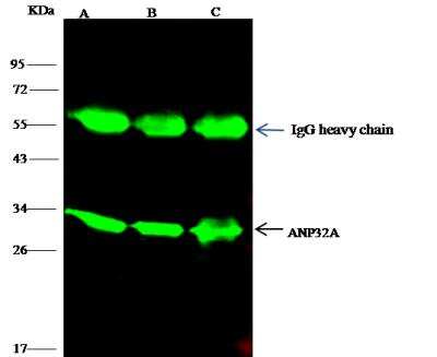 Immunoprecipitation: ANP32A Antibody [NBP2-99913]