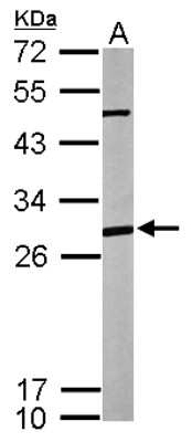 Western Blot: ANP32A Antibody [NBP2-15412]