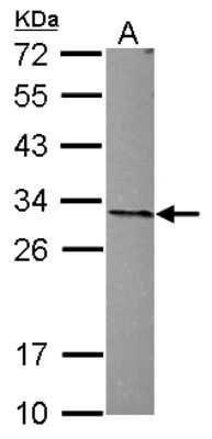 Western Blot: ANP32A Antibody [NBP2-15412]