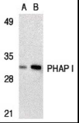 Western Blot: ANP32A AntibodyBSA Free [NBP2-25097]
