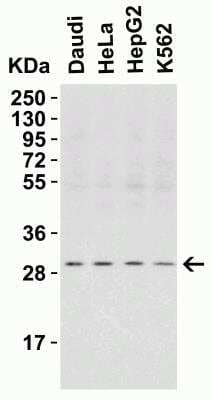 Western Blot: ANP32A AntibodyBSA Free [NBP2-25097]