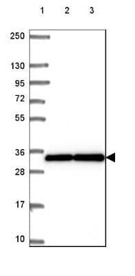 Western Blot: ANP32A Antibody [NBP2-49385]