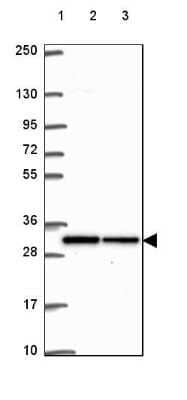 Western Blot: ANP32A Antibody [NBP2-49519]