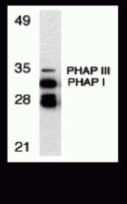 Western Blot: ANP32A AntibodyBSA Free [NBP2-81784]