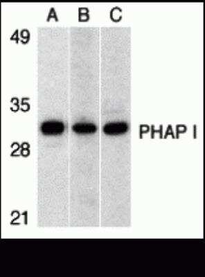 Western Blot: ANP32A AntibodyBSA Free [NBP2-81794]