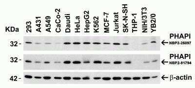 Western Blot: ANP32A AntibodyBSA Free [NBP2-81794]