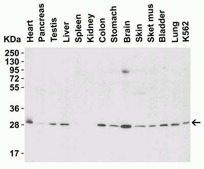 Western Blot: ANP32A AntibodyBSA Free [NBP2-81794]