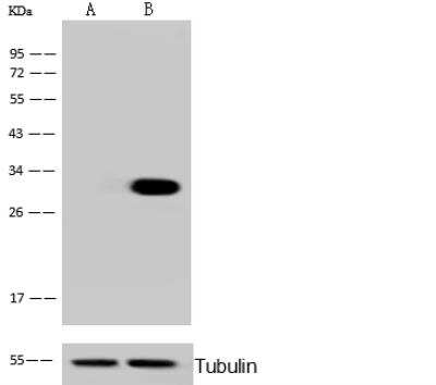 Western Blot: ANP32A Antibody [NBP2-99913]