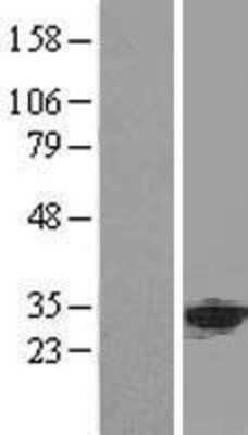 Western Blot: ANP32A Overexpression Lysate [NBL1-07550]