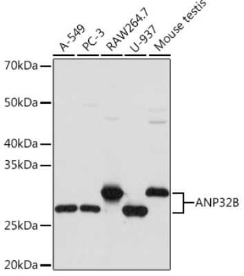 Western Blot: ANP32B Antibody (4A8E5) [NBP3-16199]