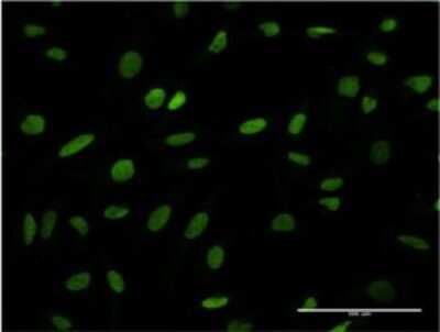 Immunocytochemistry/ Immunofluorescence: ANP32B Antibody (8E10) [H00010541-M05]