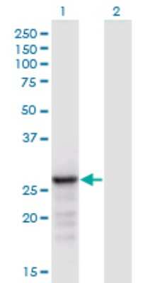 Western Blot: ANP32B Antibody (8E10) [H00010541-M05]