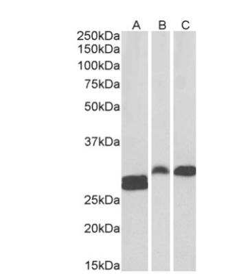 Western Blot: ANP32B Antibody [NB100-1199]