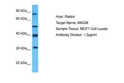 Western Blot: ANP32B Antibody [NBP2-88766]