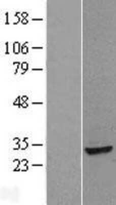 Western Blot: ANP32B Overexpression Lysate [NBL1-07551]