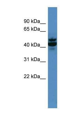 Western Blot: CMG-2/ANTXR2 Antibody [NBP1-68911]