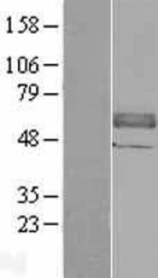 Western Blot: CMG-2/ANTXR2 Overexpression Lysate [NBL1-07555]