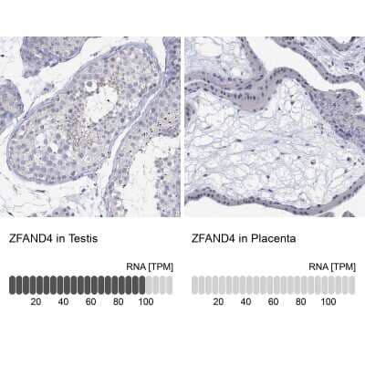 Immunocytochemistry/ Immunofluorescence: ANUBL1 Antibody [NBP3-16993]