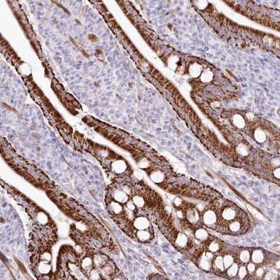 Immunohistochemistry-Paraffin: ANUBL1 Antibody [NBP1-81916]
