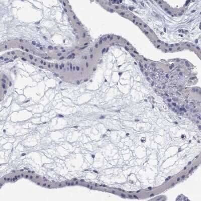 Immunohistochemistry-Paraffin: ANUBL1 Antibody [NBP3-16993]