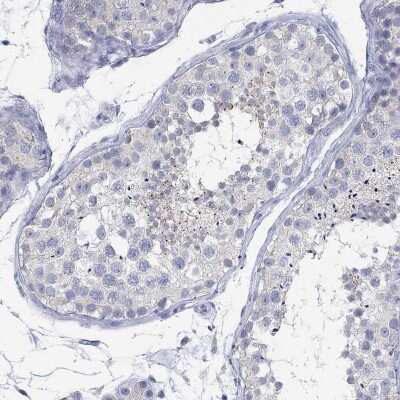 Immunohistochemistry-Paraffin: ANUBL1 Antibody [NBP3-16993]