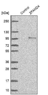 Western Blot: ANUBL1 Antibody [NBP1-81916]