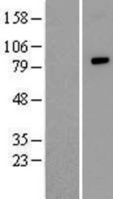 Western Blot: ANUBL1 Overexpression Lysate [NBP2-05071]