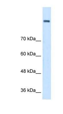 Western Blot: AOC2 Antibody [NBP1-62442]