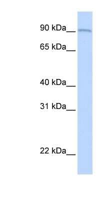 Western Blot: AOC2 Antibody [NBP1-62443]