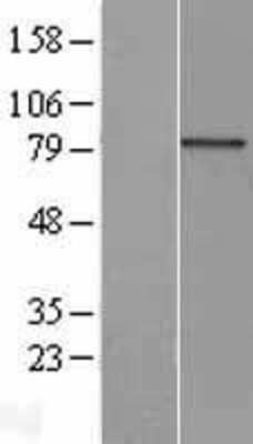 Western Blot: AOC2 Overexpression Lysate [NBL1-07570]