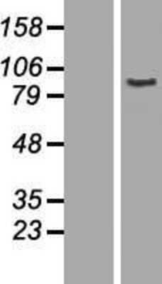 Western Blot: AOC2 Overexpression Lysate [NBP2-07500]