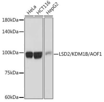 Western Blot: AOF1 Antibody (5M3W2) [NBP3-15940]