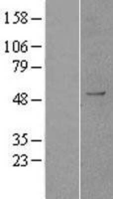 Western Blot: AOF1 Overexpression Lysate [NBP2-04430]