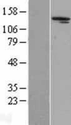 Western Blot: Aldehyde Oxidase 1/AOX1 Overexpression Lysate [NBL1-07574]