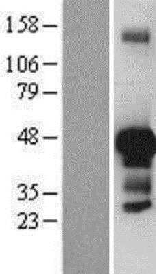 Western Blot: JunB/AP-1 Overexpression Lysate [NBP2-08130]