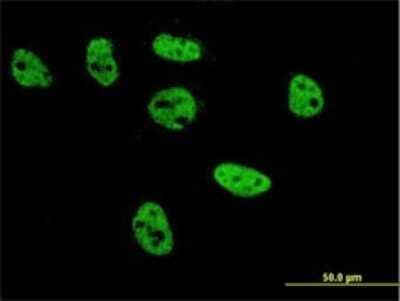 Immunocytochemistry/ Immunofluorescence: AP-2 beta/TFAP2B Antibody (2F6) [H00007021-M02]