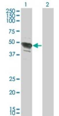 Western Blot: AP-2 beta/TFAP2B Antibody (2F6) [H00007021-M02]