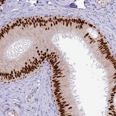 Immunohistochemistry-Paraffin: AP-2 beta/TFAP2B Antibody [NBP1-89063]