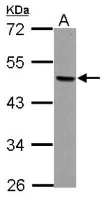 Western Blot: AP-2 beta/TFAP2B Antibody [NBP2-20606]