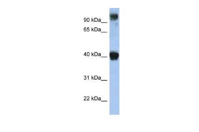 Western Blot: AP-2 epsilon/TFAP2E Antibody [NBP2-83935]