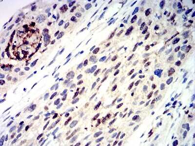 Immunohistochemistry: AP-2 gamma Antibody (3A11A5) - BSA Free [NBP2-61859]