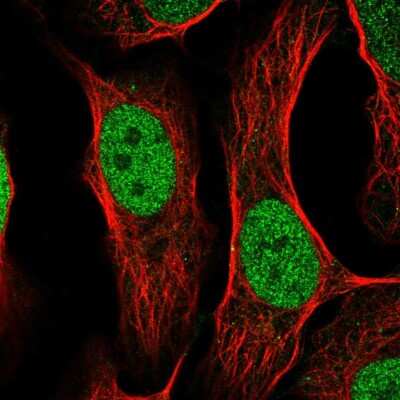 Immunocytochemistry/ Immunofluorescence: AP-2 gamma Antibody [NBP2-55343]