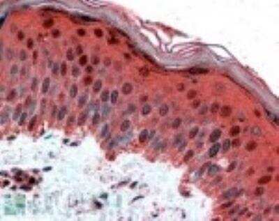 Immunohistochemistry-Paraffin: AP-2 gamma Antibody [NB100-1516]