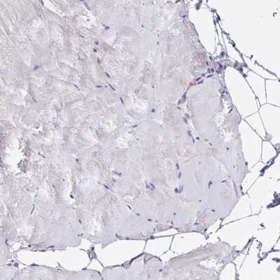Immunohistochemistry-Paraffin: AP-2 gamma Antibody [NBP2-49170]