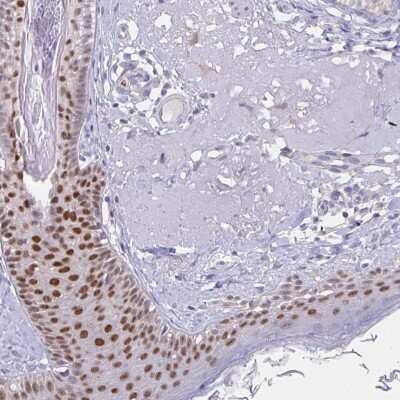 Immunohistochemistry-Paraffin: AP-2 gamma Antibody [NBP2-49170]