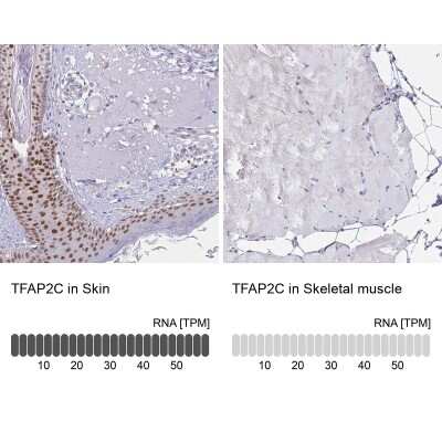 Immunohistochemistry-Paraffin: AP-2 gamma Antibody [NBP2-49170]