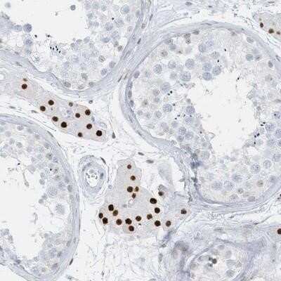 Immunohistochemistry-Paraffin: AP000322.53 Antibody [NBP1-91141]