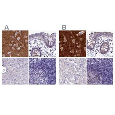 Immunohistochemistry-Paraffin: AP180 Antibody [NBP1-90146]
